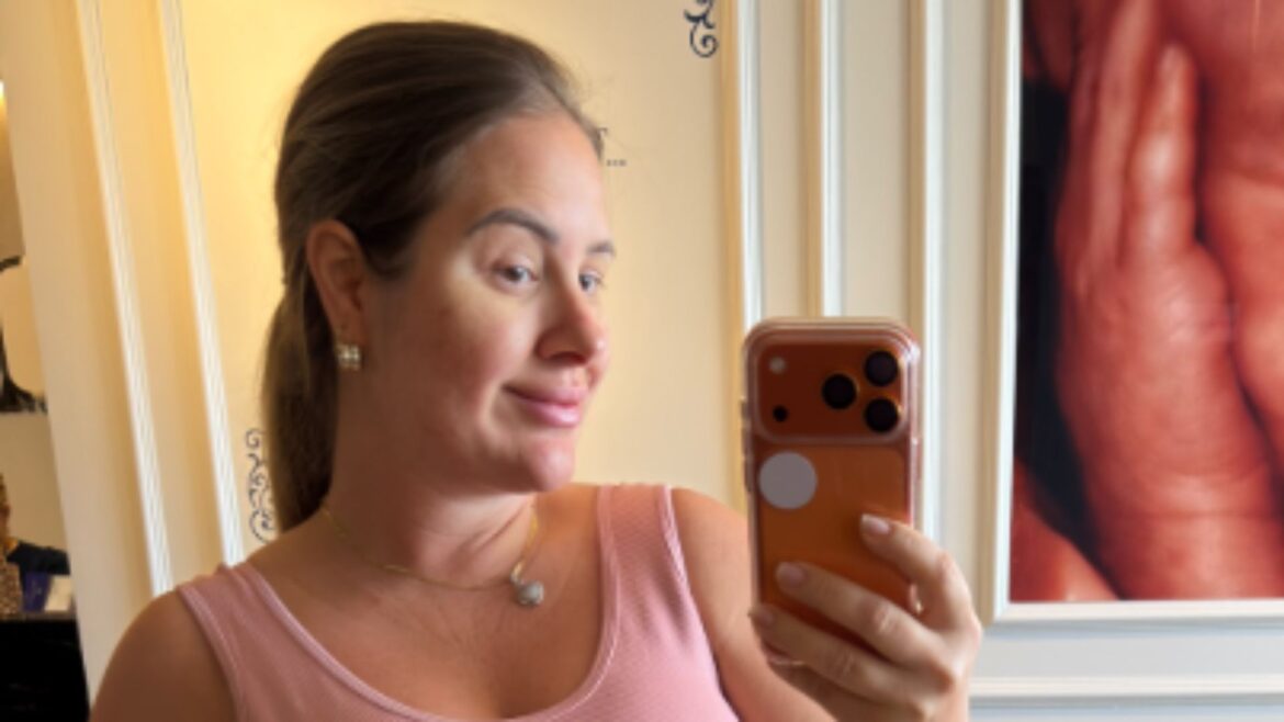 😱 GRÁVIDA, Patrícia Leitte mostra susto com manchas no corpo