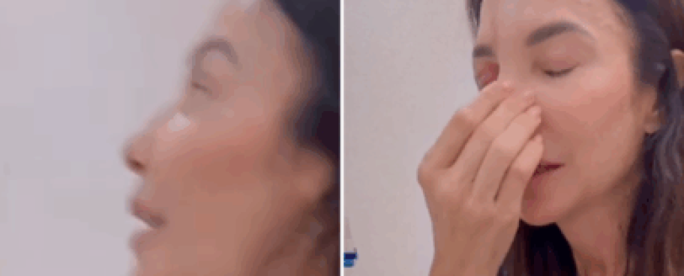 😱 Ivete Sangalo mostra rosto após cirurgia e web questiona 😱 Ivete Sangalo mostra rosto após cirurgia e web questiona