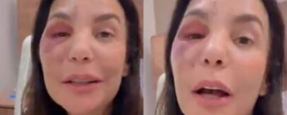 🔥 IVETE SANGALO TEM ALTA: O susto, a cirurgia e como ela está 🔥 IVETE SANGALO TEM ALTA: O susto, a cirurgia e como ela está