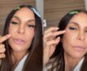 😱 Ivete revela cirurgia no rosto: "Cheio de sanguinho"