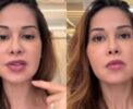 🚨 URGENTE: Maíra Cardi fará cirurgia no rosto por necrose
