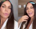 🚨 Ivete Sangalo revela sequela no rosto após cirurgia: "Susto"